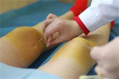 北京京通医院,京通医院艾灸养生